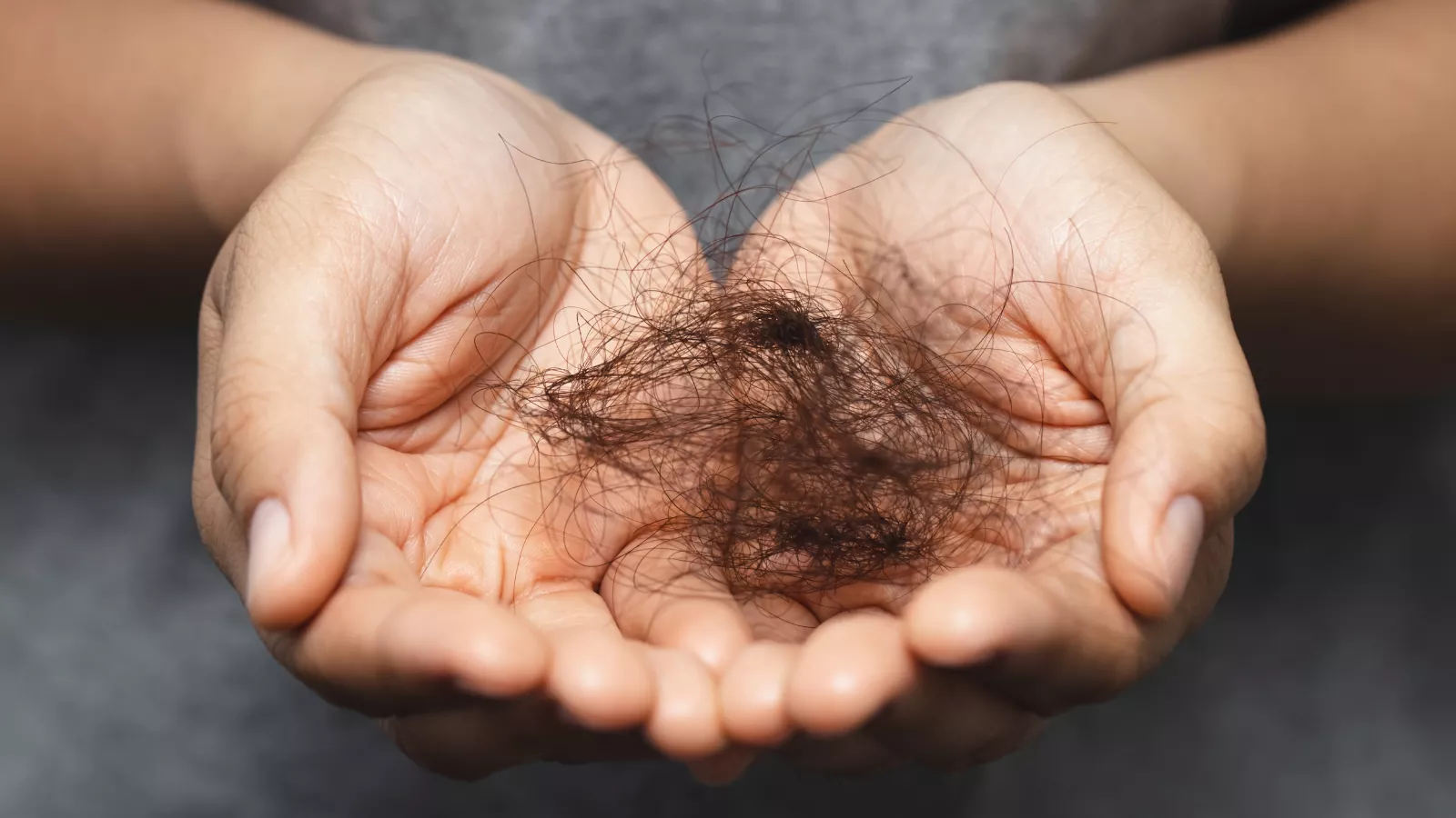 להתמודד עם הראש מורם: נשירת שיער לאחר הקרנות והדרך חזרה ממנה