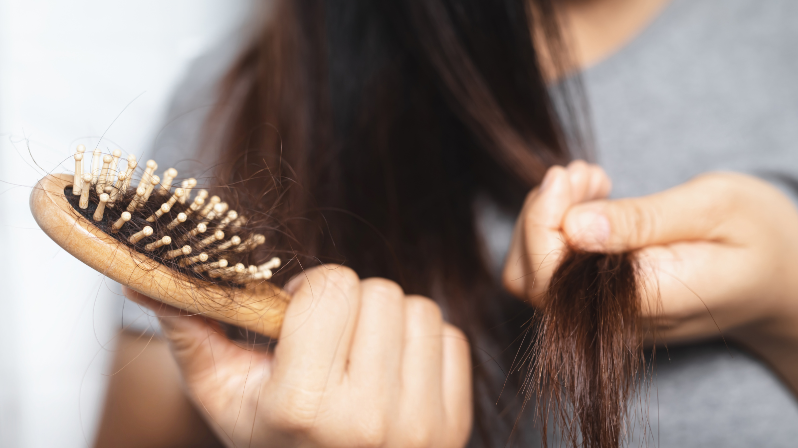 נשירת שיער לאחר הקרנות